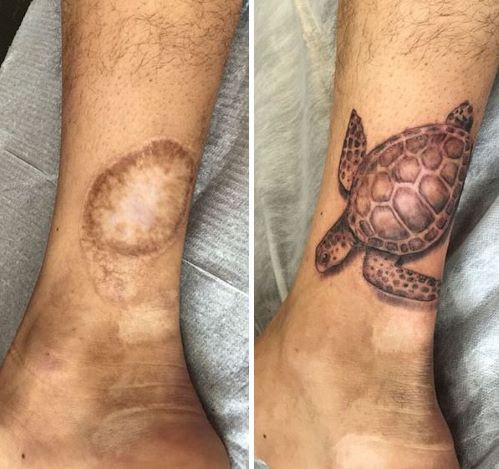 Tattoo Scar - Turtle.JPG